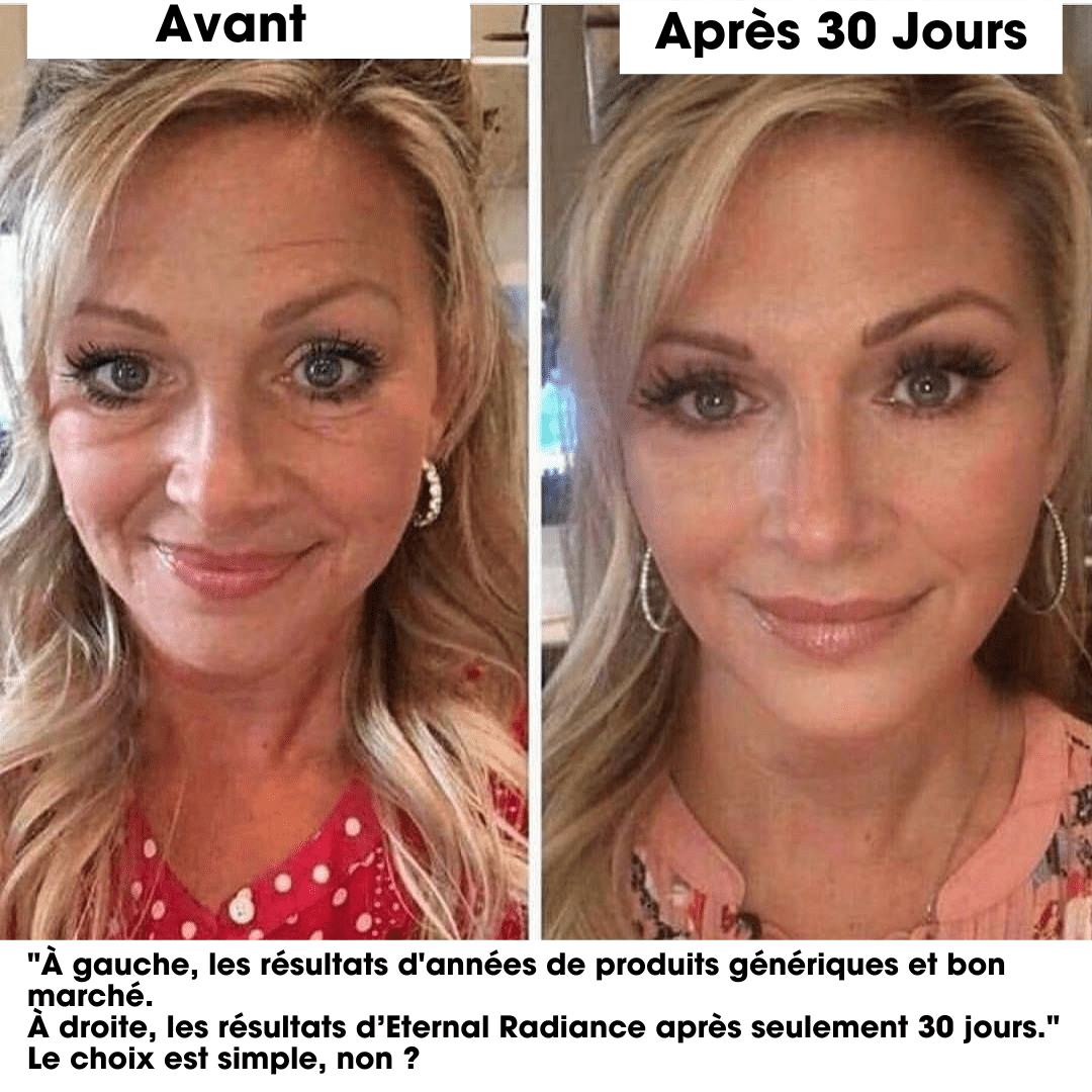 //elevaine.co/cdn/shop/files/amz_rev-min.png?v=1754729162