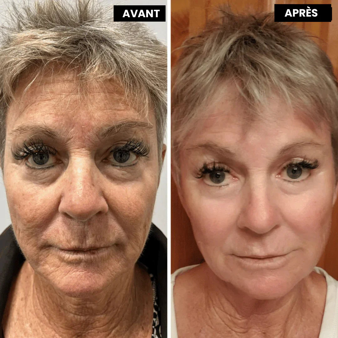 Rétinol et Peau Sensible : L'Alternative Douce Qui Change Tout