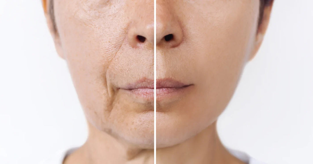 Lifting Sans Chirurgie : Ce Que Peut Vraiment Faire Un Soin Anti-Âge à 55 Ans