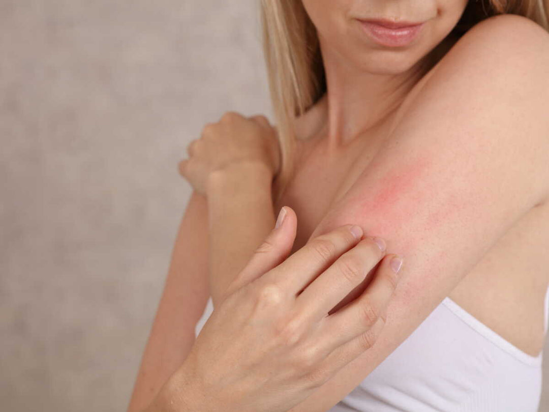 Peau Sensible Ménopause : Quand Tout Brûle, Que Faire ?