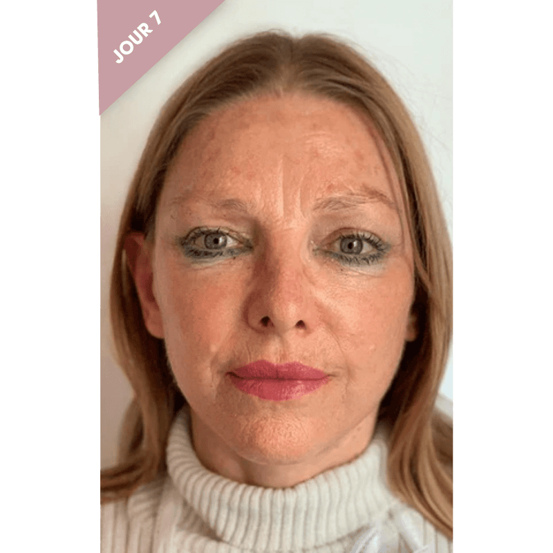 Claudia jour 7
